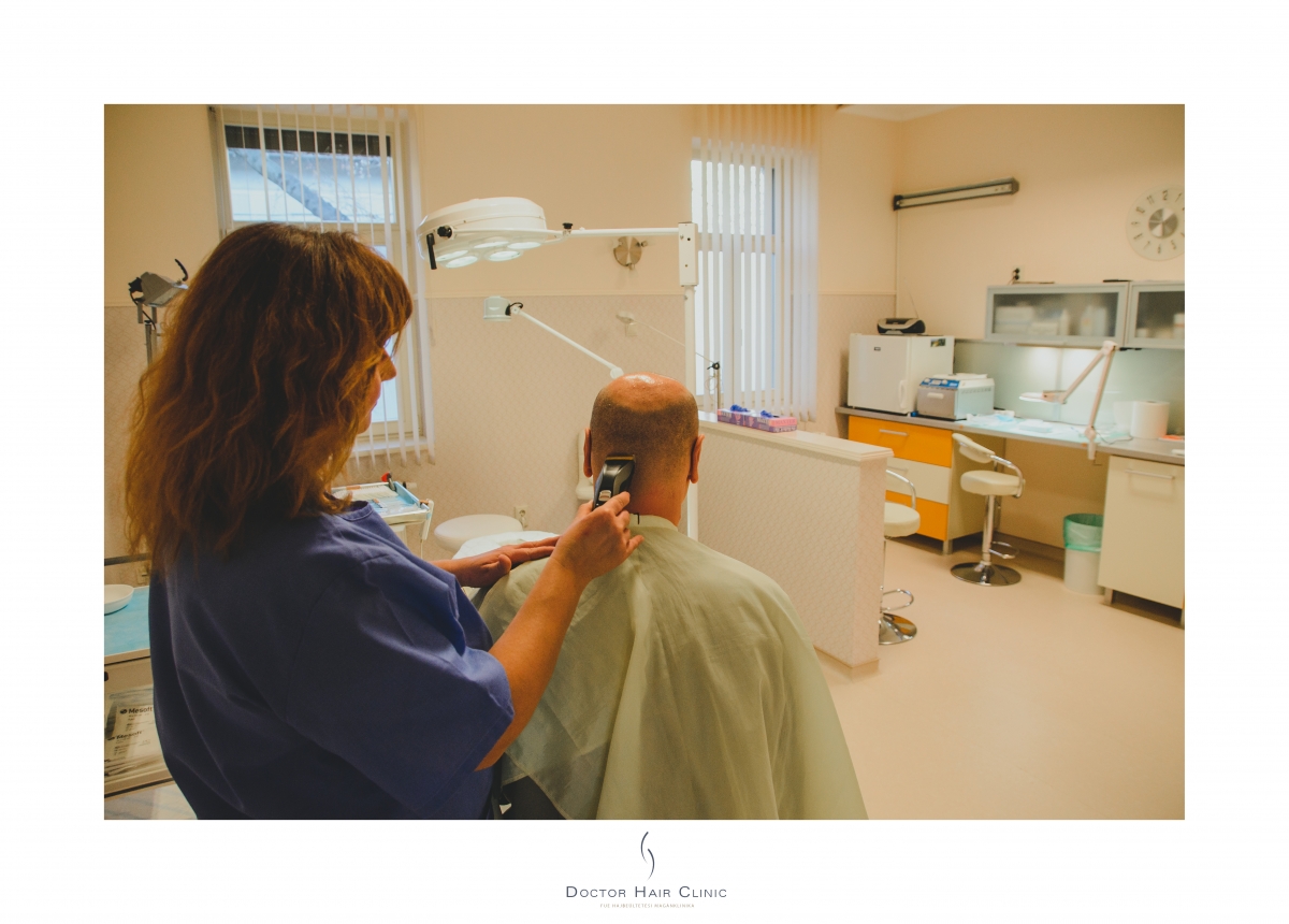 FUE hajbeültetés menete