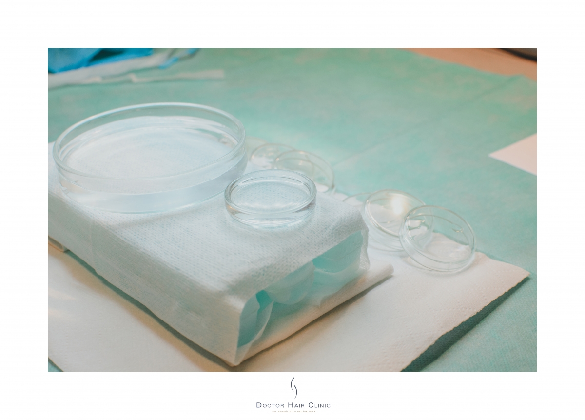 FUE hajbeültetés menete