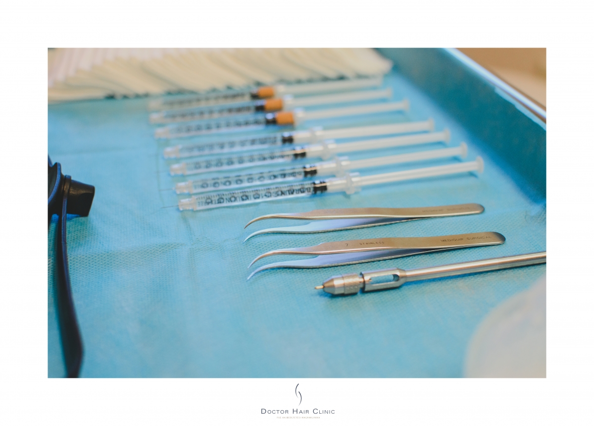 FUE hajbeültetés menete